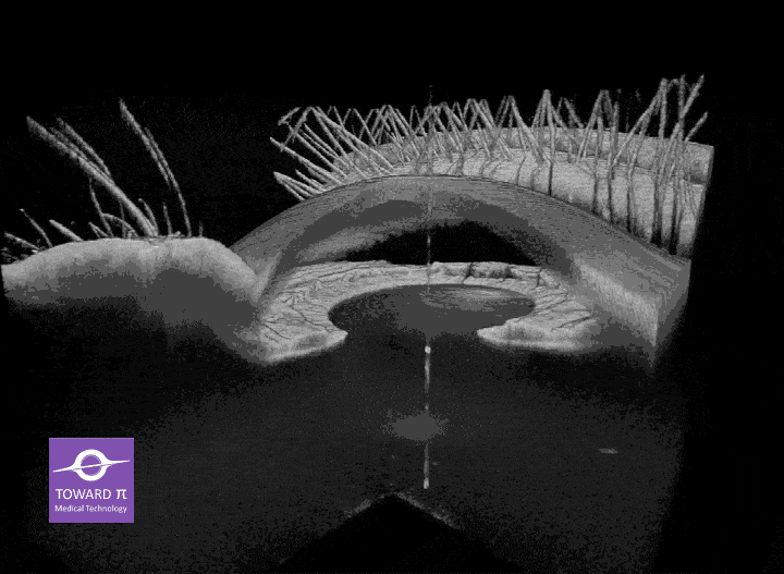 TowardPi Yalkaid 3D anterior scan