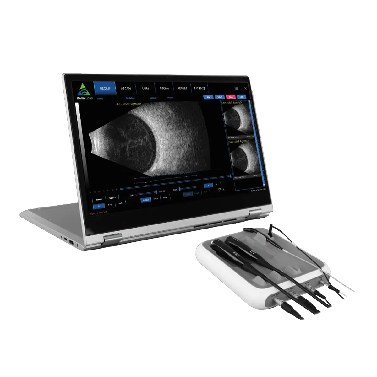 SUOER SW-21 UBM SUOER SW-21 UBM